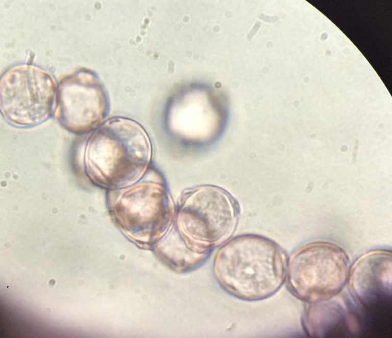 What Does Pollen Look Like And Where Does It Come From 